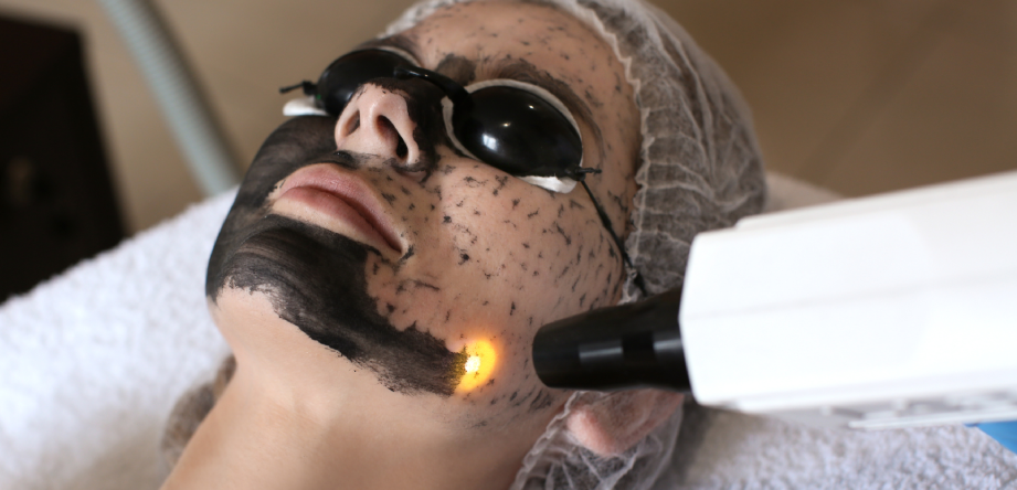 Hollywood Peel